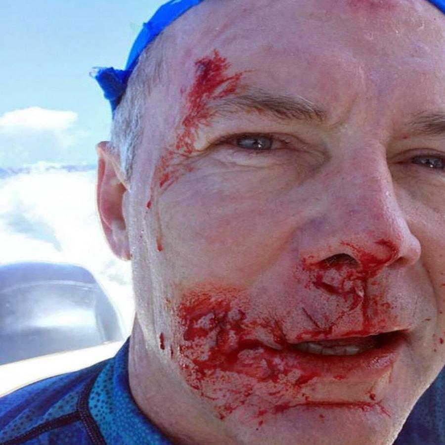 Waco Dentist Survives Shark Attack In Bahamas Local News Wacotrib Com