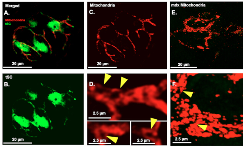 New method offers a closer look at cells that help nerves repair