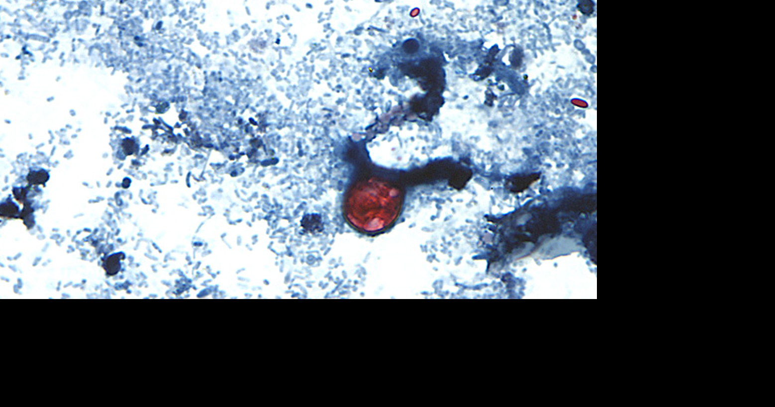 Where in Texas is cyclosporiasis being found? Two regions account for majority of reported illnesses