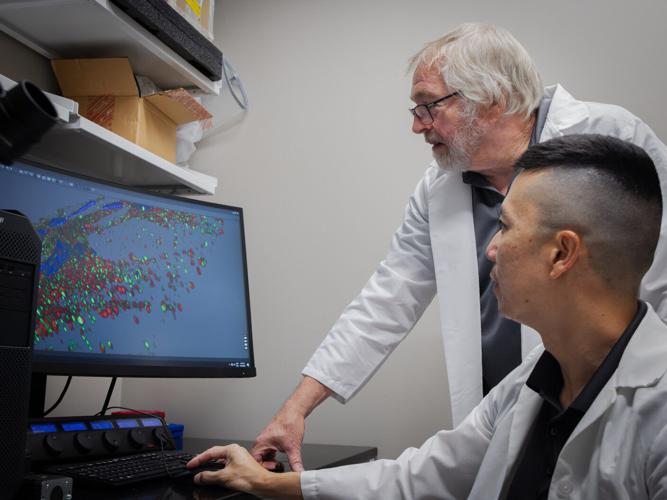 Tiny molecules may help slow pancreatic cancer growth