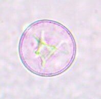 Juniper pollen 2 (1)