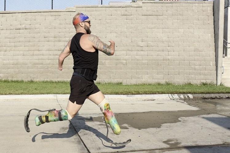 "I want to go adventure": Plattsmouth amputee will run sixth half-marathon in Scottsbluff