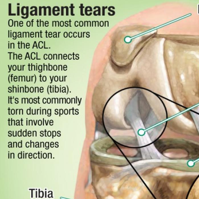 Science Easing Pain Of Ligament Damage Knee Surgery No Longer