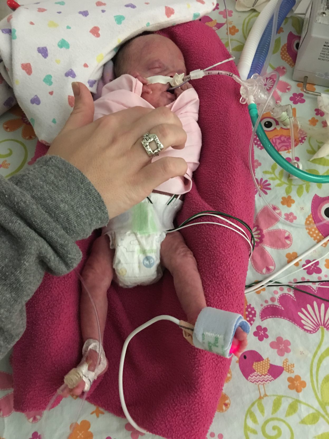 premature baby at 5 months