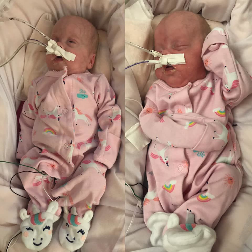 premature twins 28 weeks