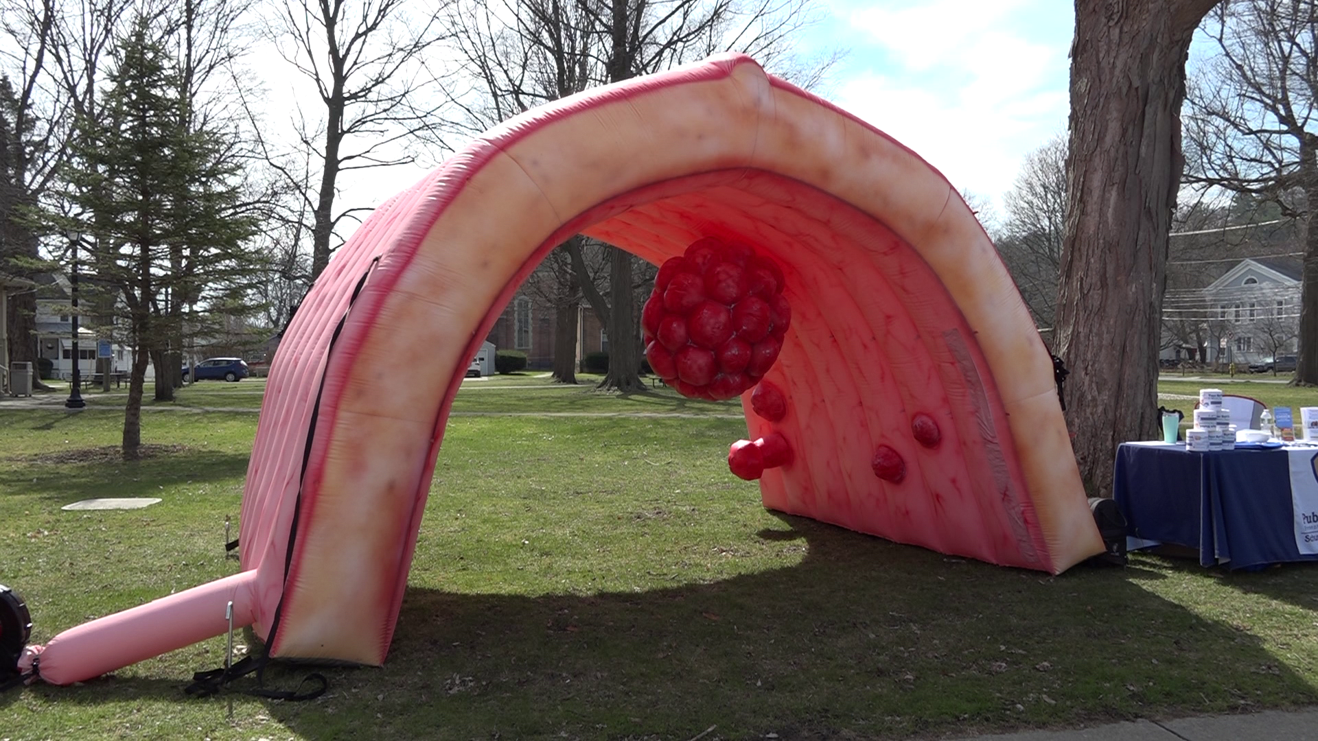 Giant Inflatable Colon Comes to Lafayette Park in Watkins Glen | Local ...