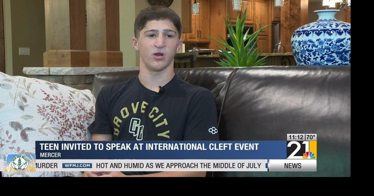 Mercer teen invited to speak at international cleft event to tell his ...