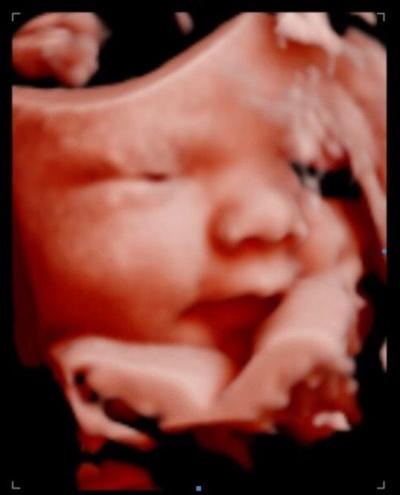 business offers expectant mothers