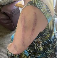 Sheriff's Office Releases Photo From Central Minnesota Bear Attack