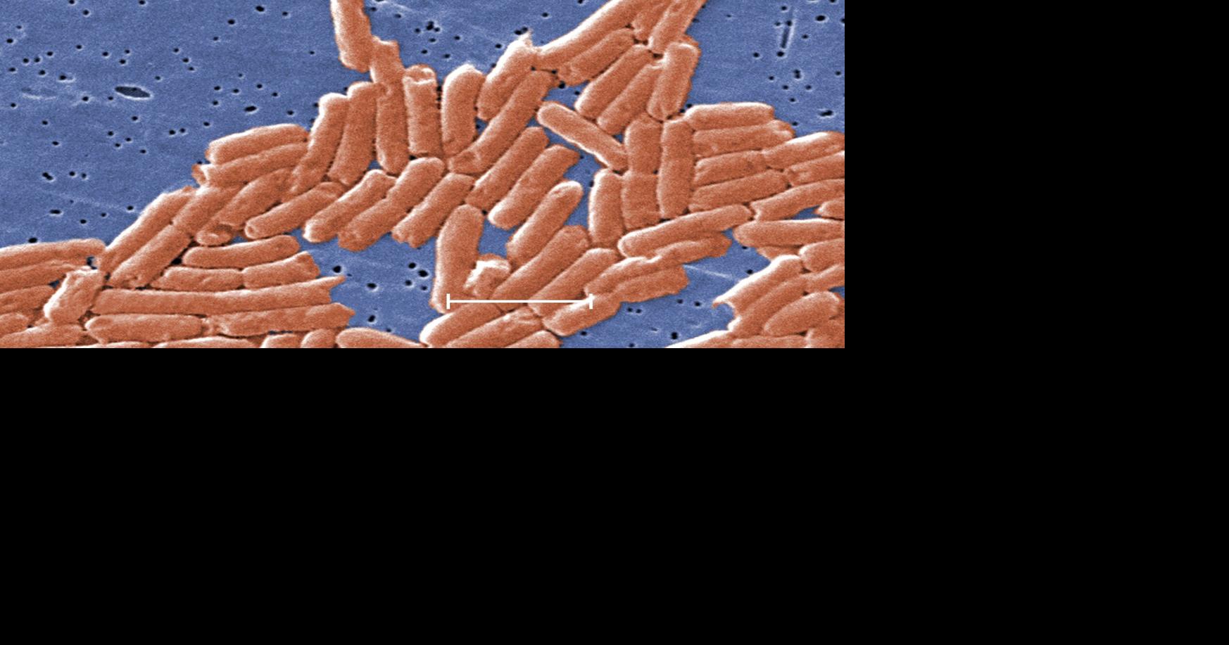Salmonella-linked jalapeño recall affects Kroger, Walmart, Trader Joe's