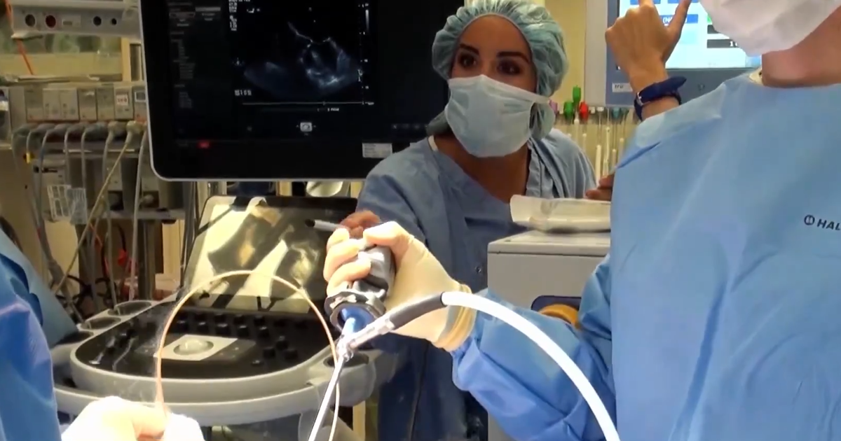 Port Charlotte patient hails aquablation as a 'miracle' prostate solution