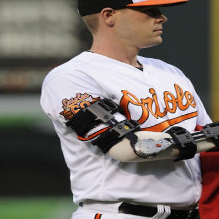 Tommy John Surgery A Growing Issue For Young Players Pro Sports Winonadailynews Com