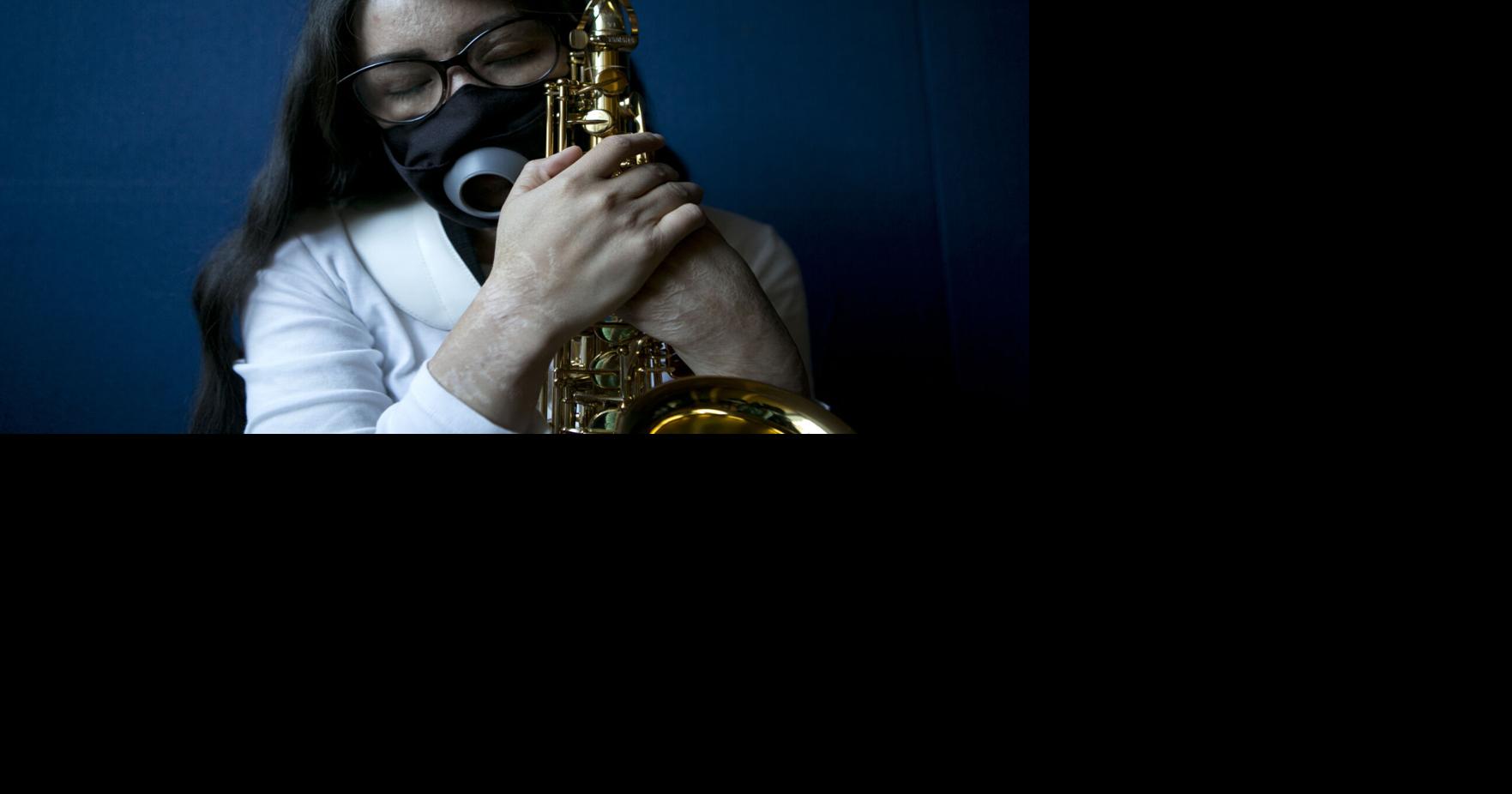 Mexican musician finds refuge in saxophone after acid attack
