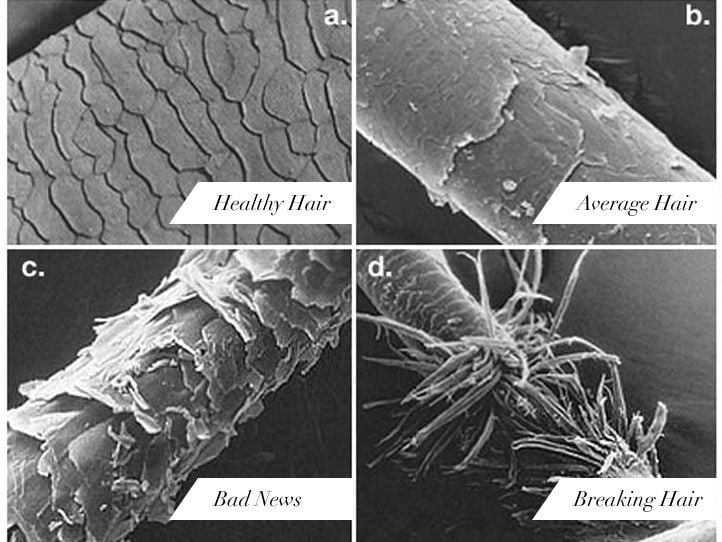 Electron microscope images of hair shafts