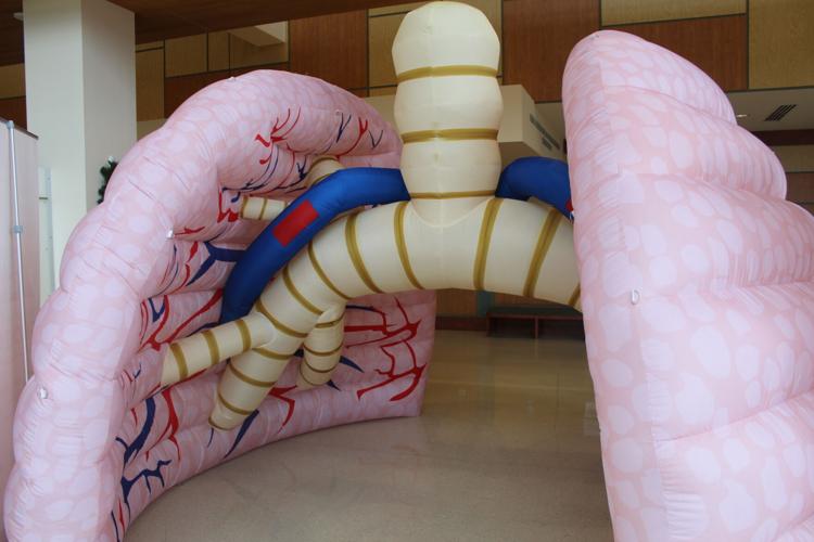 Inflatable Lung Display West Virginia doctors urge smokers to quit, highlight lung cancer risks ...