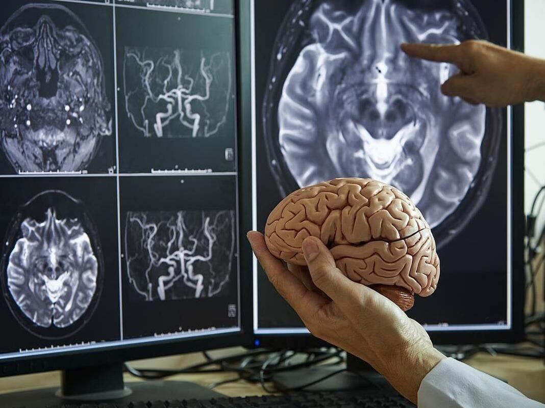 Tu cerebro cambia en etapas a medida que envejeces, según un estudio |  Around The Web | wvnews.com, image size:1200x900