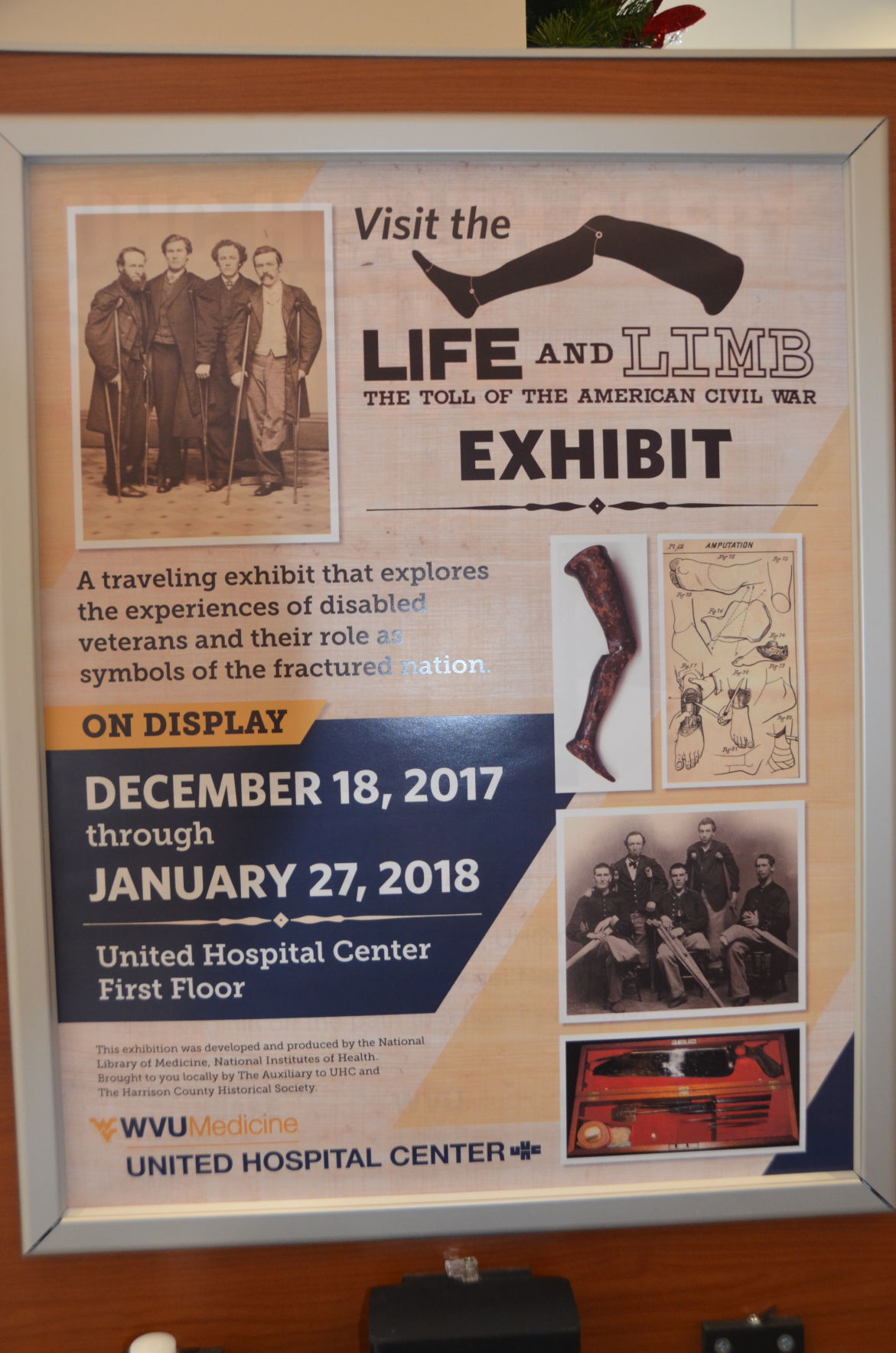 UHC Hosts 'Life And Limb: Toll Of The Civil War' Display Monday- Jan ...