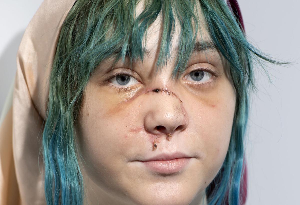 Elise Poole protest injury