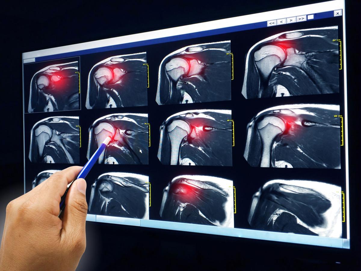 mayo-rotator-cuff-20200917