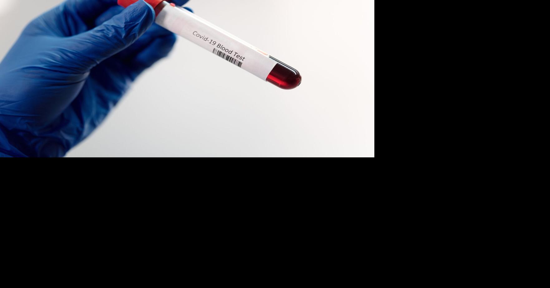 Here's where you can get COVID19 antibody tests done in Ontario