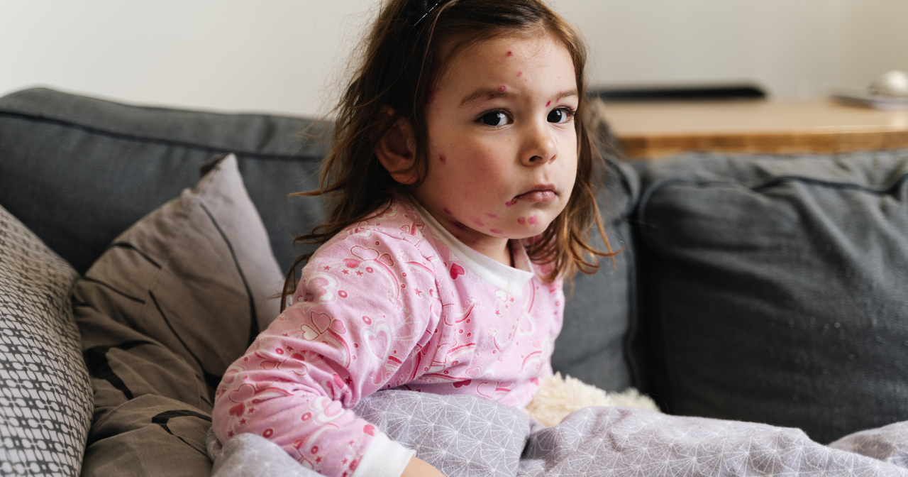 Measles Resurgence: Sharp rise in U.S. cases sparks public health alarm - Vimarsana News