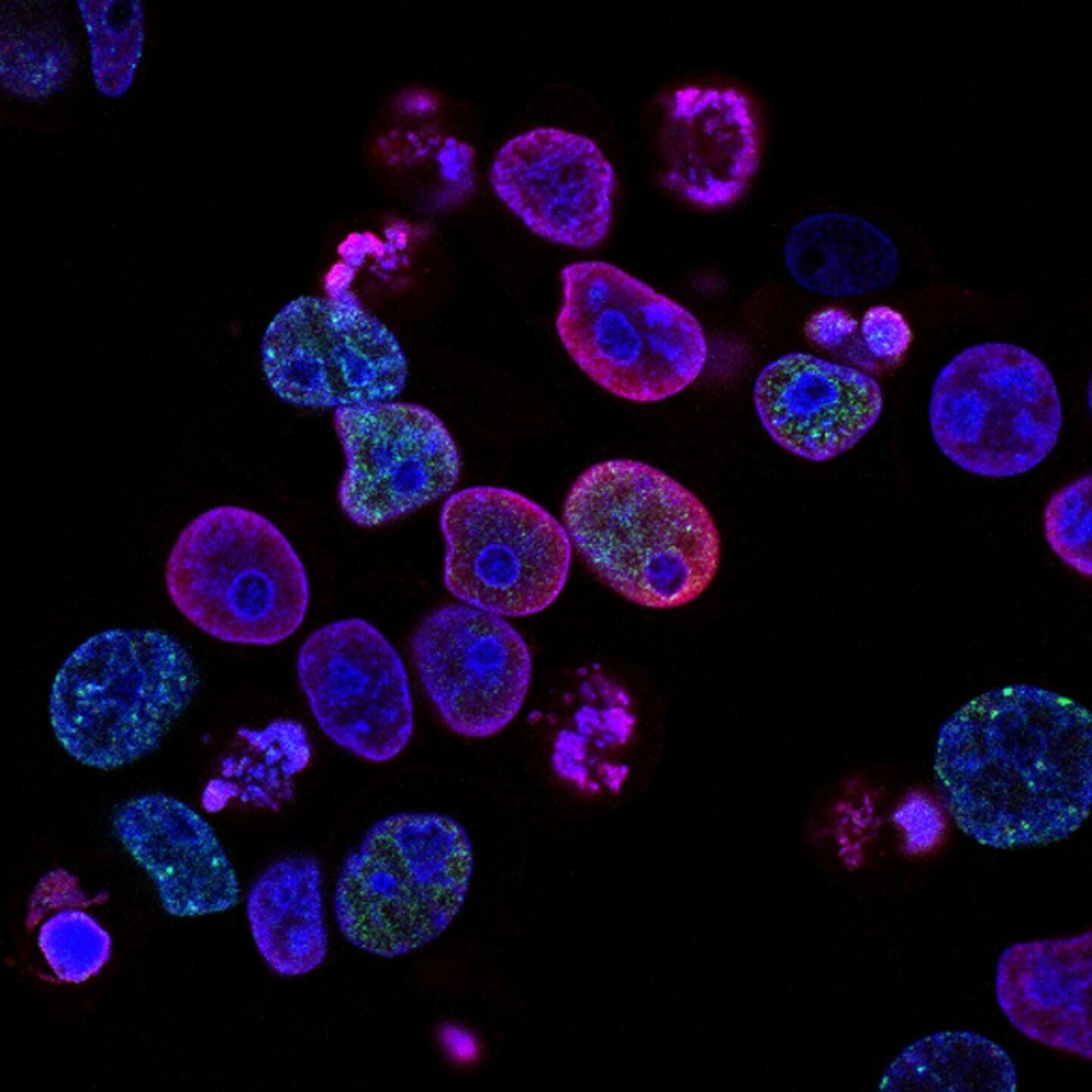<a href="https://www.youralaskalink.com/arts_and_entertainment/health/national-cancer-institute-l7en7lb-ovc-unsplash-3/image_ee870ad5-f195-5c82-a02a-98eaeb8781cd.html" target="_blank">national-cancer-institute-L7en7Lb-Ovc-unsplash (3)</a>