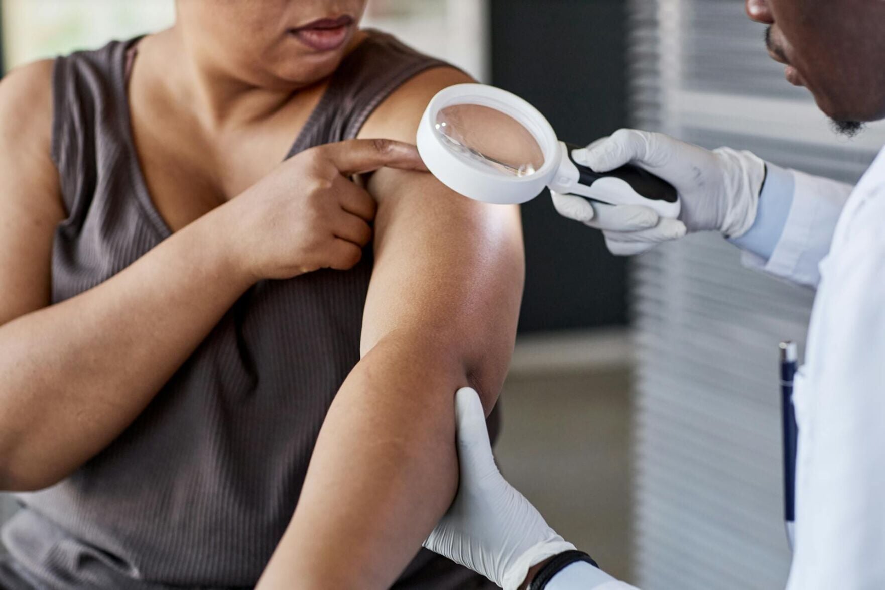 <a href="https://www.youralaskalink.com/arts_and_entertainment/health/ai-skin-cancer-detection-tools-are-getting-better-but-only-for-people-with-light-skin/article_aa1b812f-c3e0-5f63-9e70-152fa6c73ea1.html" target="_blank">AI skin cancer detection tools are getting better – but only for people with light skin</a>